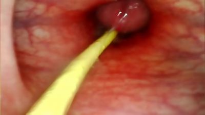 extraordinary ass fucking POV. CAMERA inside HER anus AS I penetrate HER WITH MY thick weenie AND spunk DEEP inside